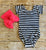 Black & White Stripe Cap Sleeve Leotard